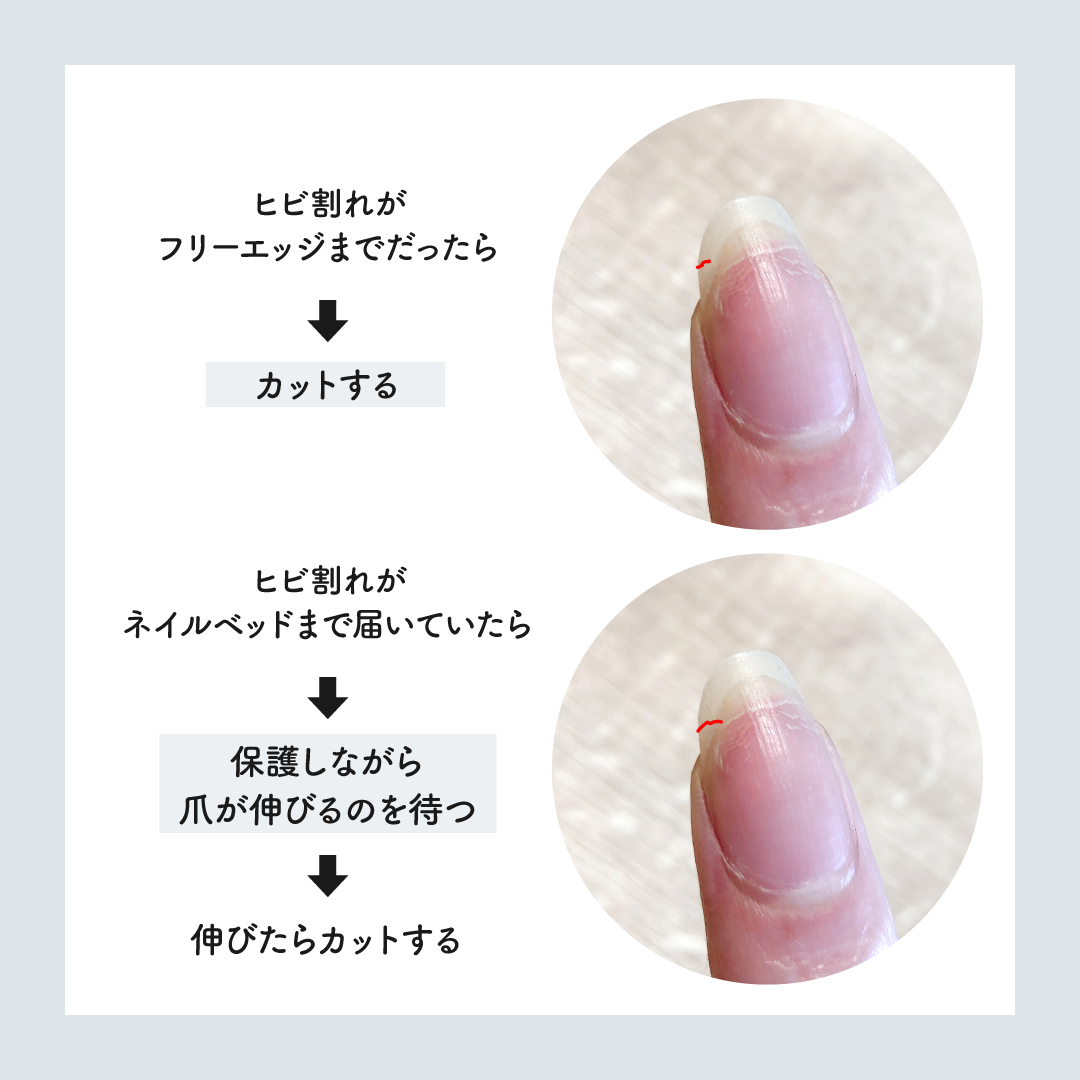 自宅でできる 爪が割れたときや割らないための対処法 ネイルサロン Nail Station